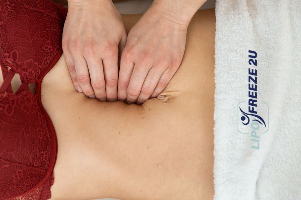 diastasis recti treatment Watford