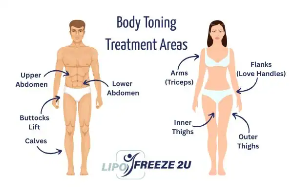 Graphic showing where you can have Body toning Treatment Watford on your body