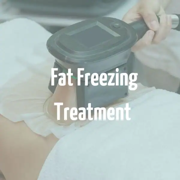 fat freezing treatment Watford