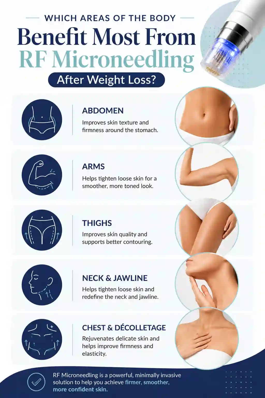 Which Areas of the Body Benefit Most From RF Microneedling After Weight Loss Watford